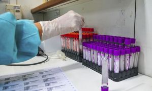 Hospital investiga se pacientes foram reinfectados pelo coronavírus Acácio Pinheiro Agência Brasília